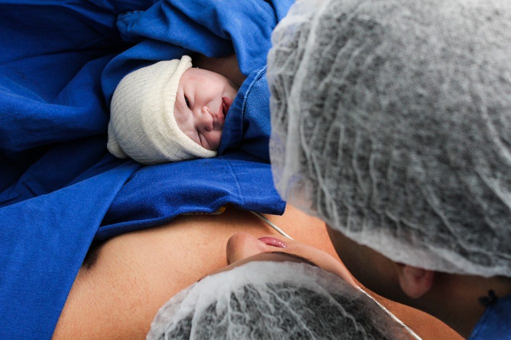 Neonato subito dopo il parto con cordone ombelicale, fonte primaria di cellule staminali per la paralisi cerebrale