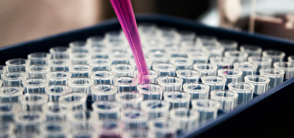 Conservazione sangue cordonale: cellule staminali cordone ombelicale in criobanca